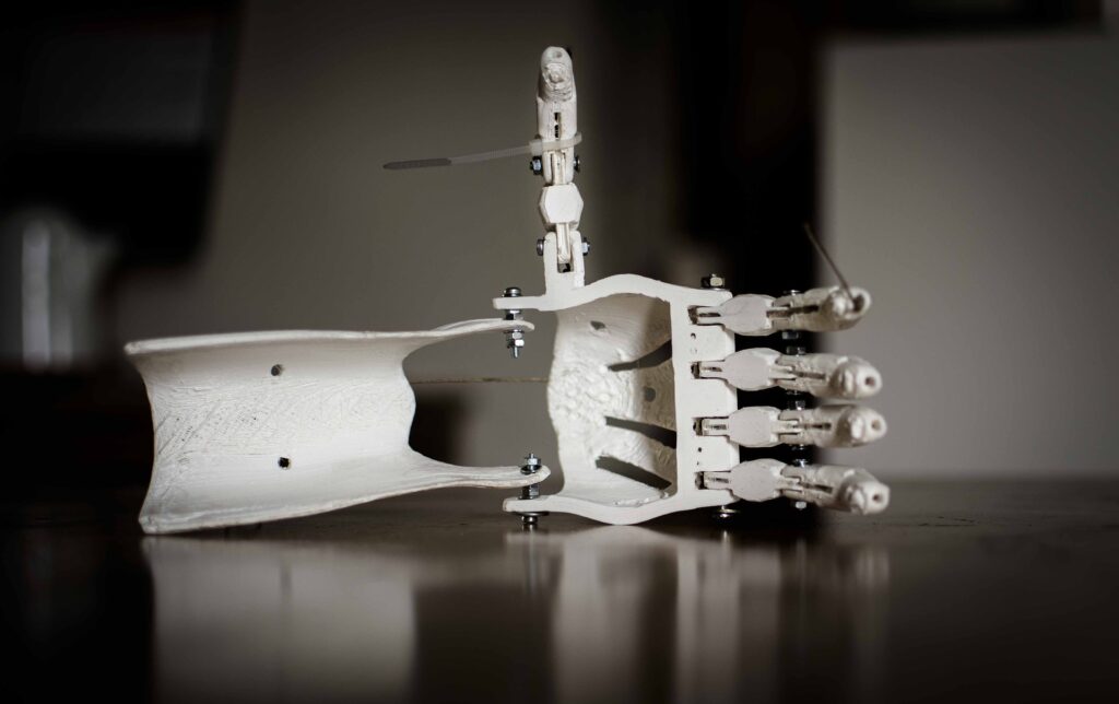 prosthetic hand